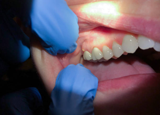 Best Emergency Dental Surgery in Fort Carson, CO