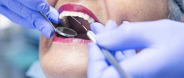 Best After-Hours Emergency Dentist in Fort Carson, CO